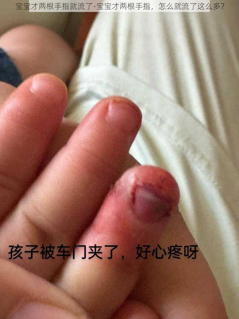 宝宝才两根手指就流了-宝宝才两根手指，怎么就流了这么多？